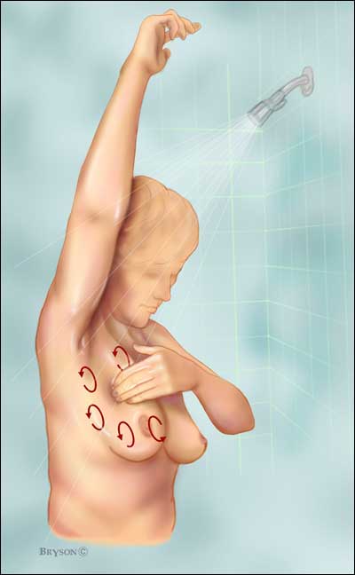 breast_self_exam42_tcm8-78531
